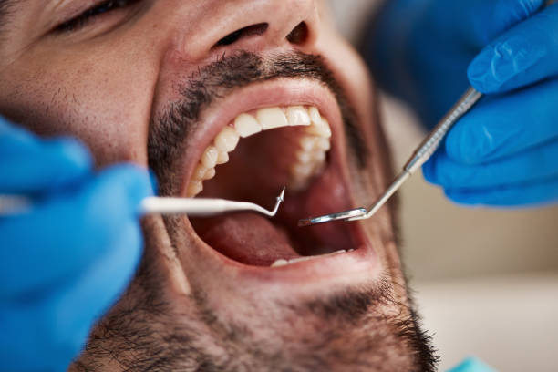 Emergency Dental Services in Vine Hill, CA